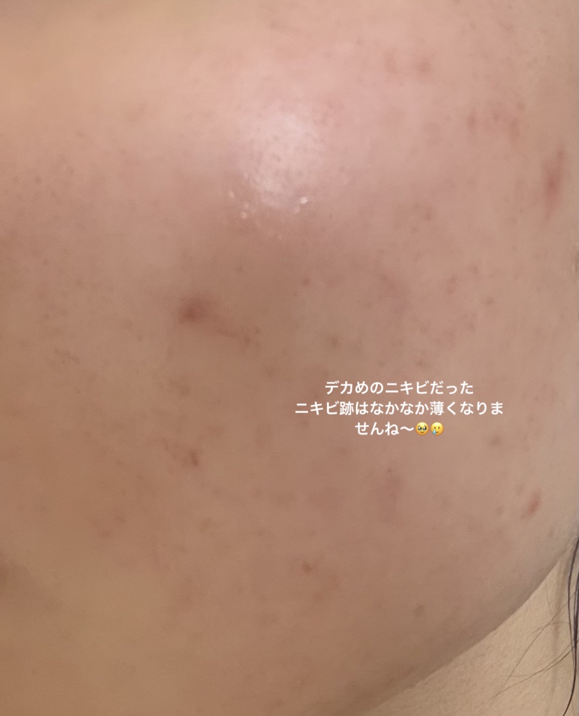 カルシウム／マグ/DHC/健康サプリメントを使ったクチコミ（2枚目）