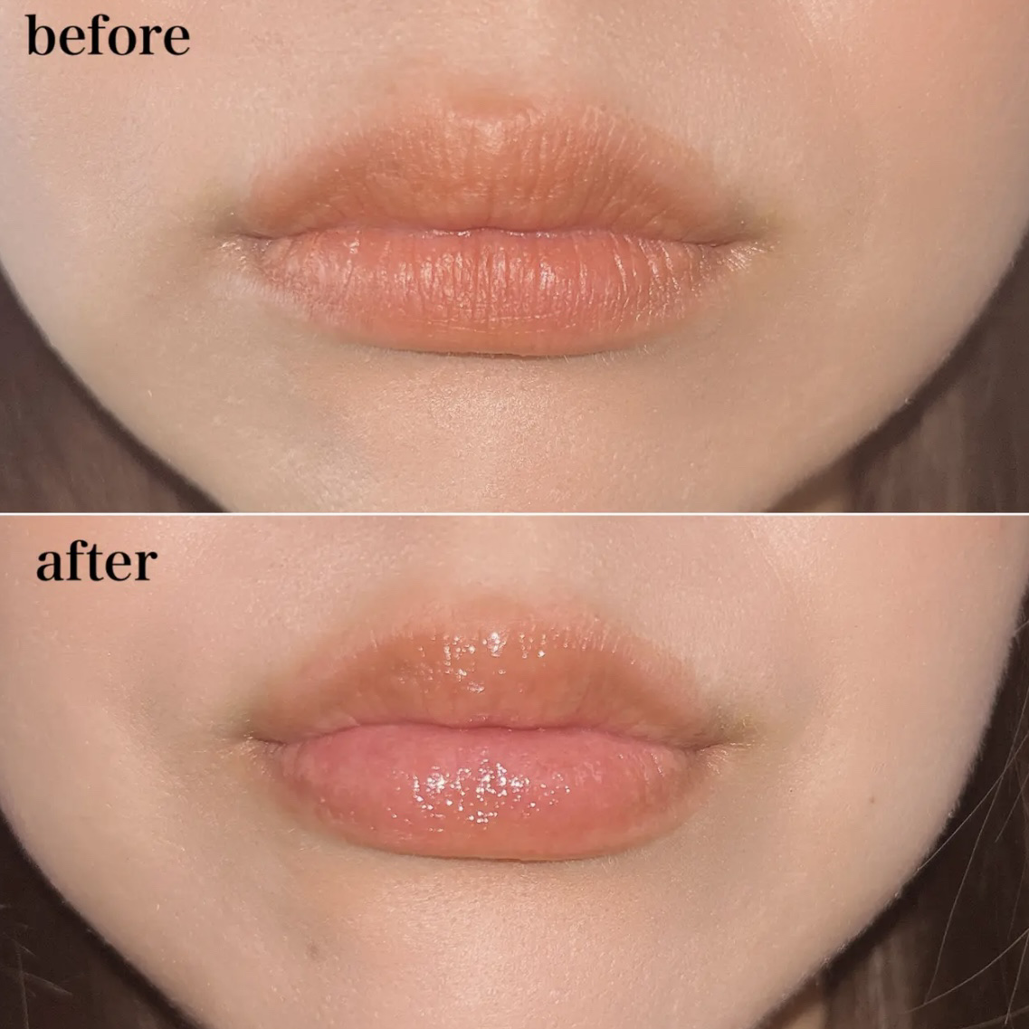 リードルS リッププランパービギナー/VT/リッププランパーを使ったクチコミ（2枚目）