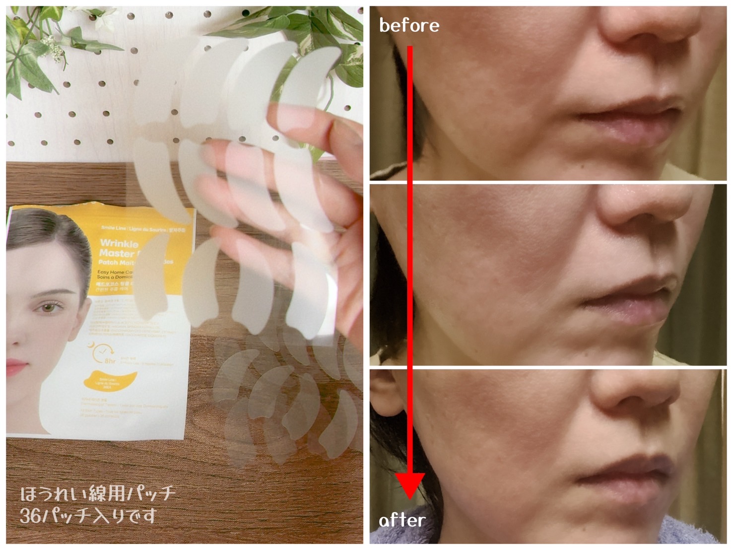 リンクルマスターパッチ | S-zone/MADFORCOS/シートマスク・パックを使ったクチコミ（2枚目）