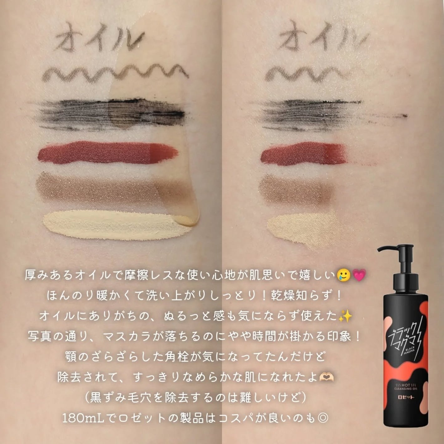 ブラックマグマ ホットクレンジングジェル/ロゼット/クレンジングジェルを使ったクチコミ(3枚目)