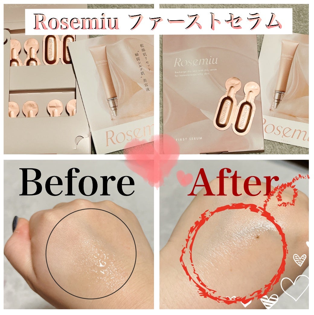 ファーストセラム/Rosemiu/美容液を使ったクチコミ(1枚目)