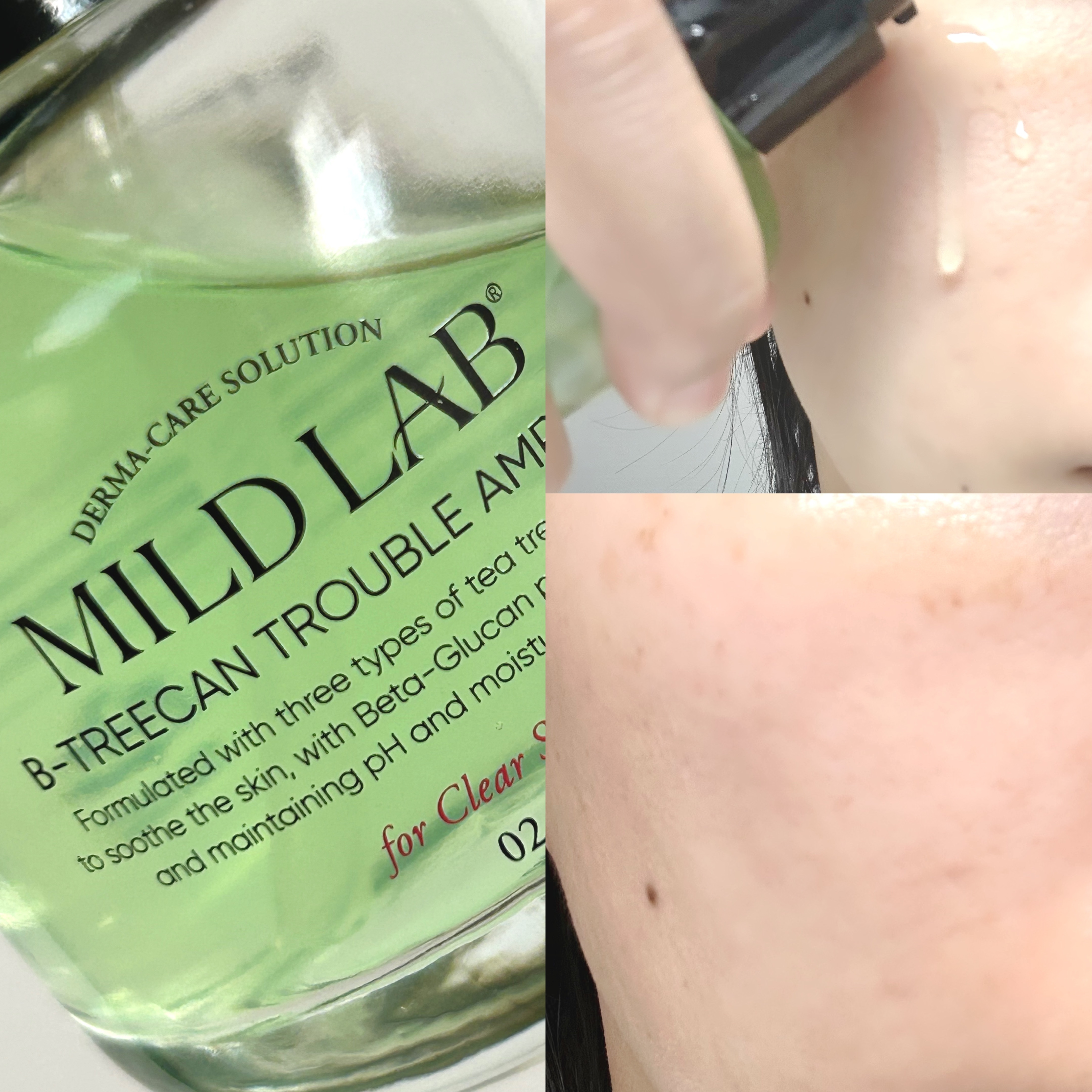 ベターツリカン肌荒れ美容液/Mildlab/美容液を使ったクチコミ（3枚目）