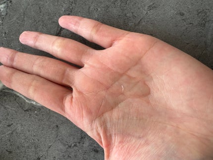 8ヒアルロン酸 リポソームスキンブースター/Anua/化粧水を使ったクチコミ(2枚目)