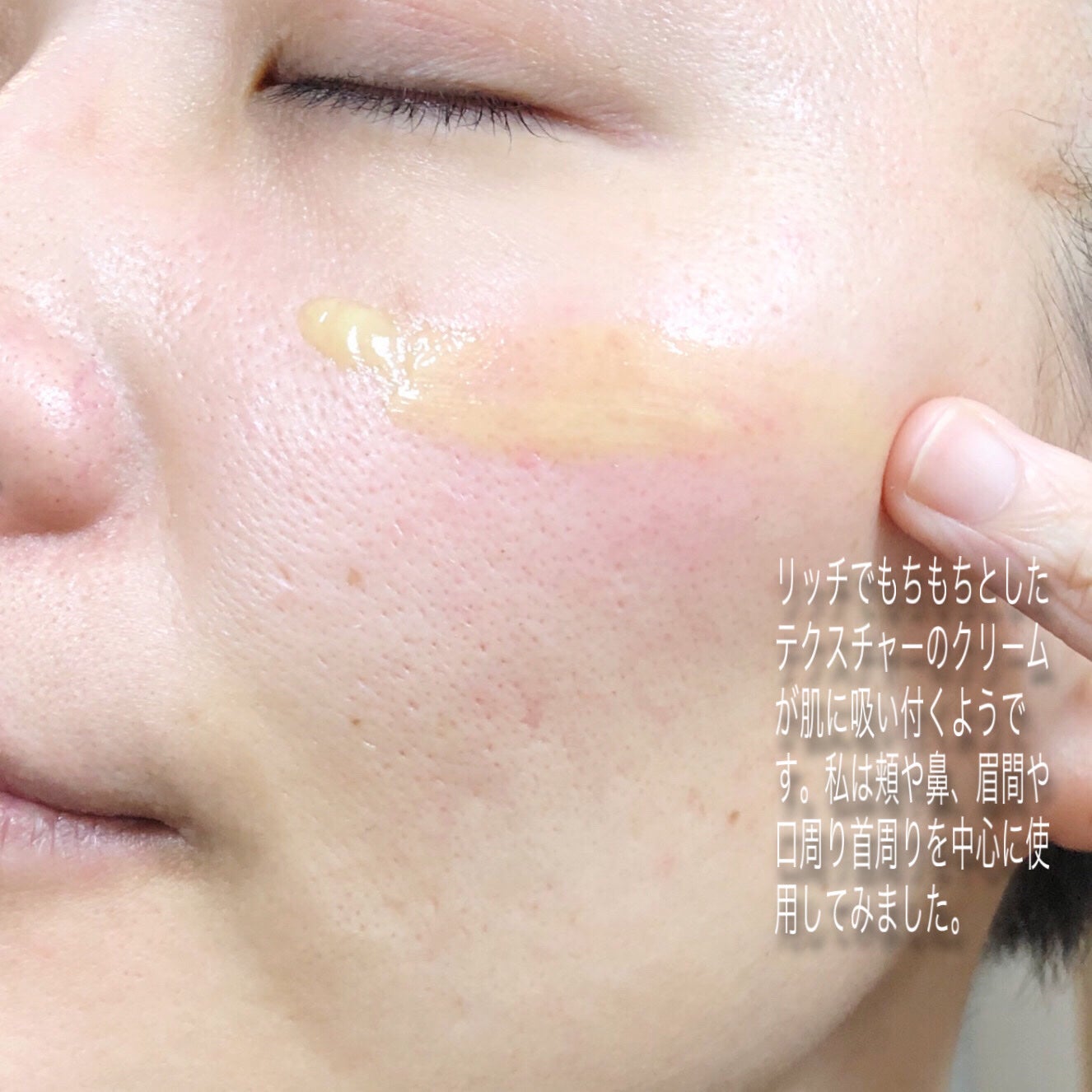 VITALIFT A forte/Dr.Different/フェイスクリームを使ったクチコミ(5枚目)