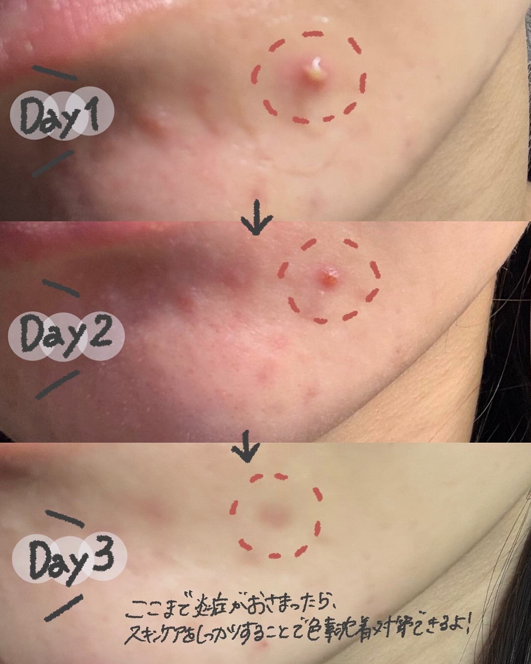 AZケア クレンジングオイル/VT/オイルクレンジングを使ったクチコミ(4枚目)