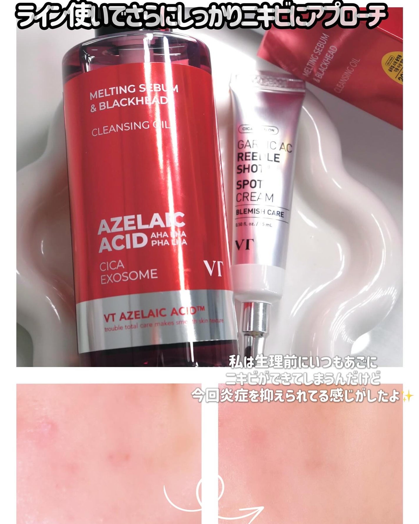 AZケア クレンジングオイル/VT/オイルクレンジングを使ったクチコミ(7枚目)