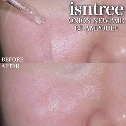 オニオンニューペア B5アンプル/Isntree/美容液を使ったクチコミ(8枚目)