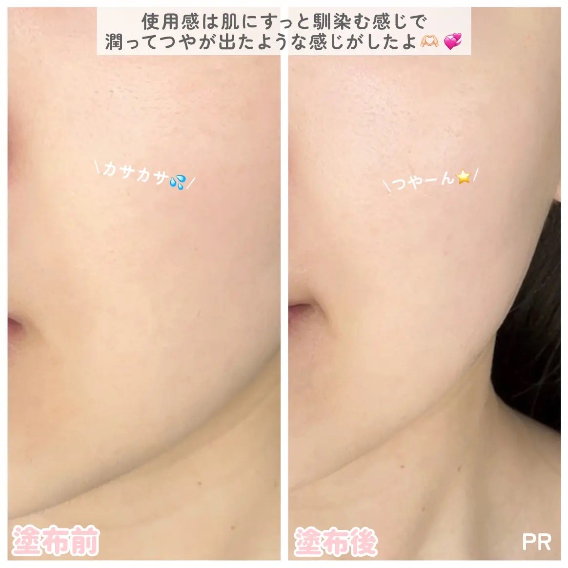 è¬çšããŒã·ã§ã³ ã»ã³ã·ãã£ãEX/ãã¯ã¿ãŒã·ãŒã©ãâ/åç²§æ°Žã䜿ã£ãã¯ãã³ãïŒ4æç®ïŒ