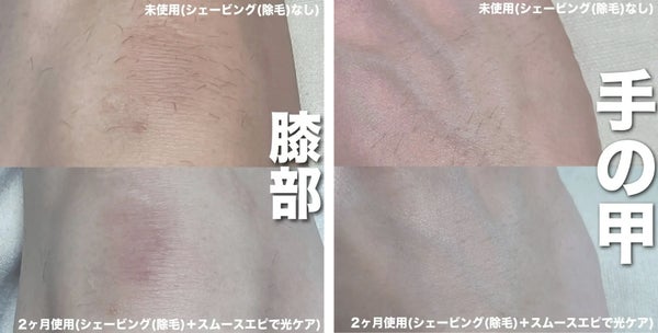 パナソニックの家庭用光美容器にムーブメントの予感!『実際どう?家でムダ毛ケア』の画像