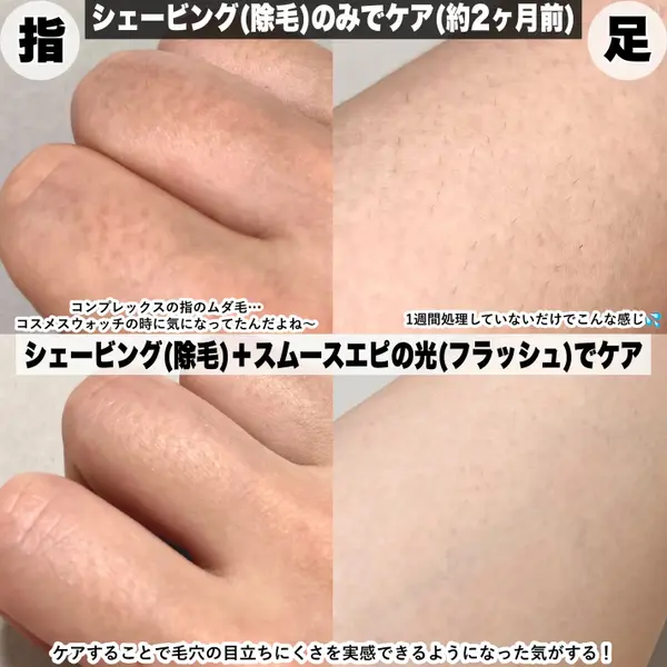 パナソニックの家庭用光美容器にムーブメントの予感!『実際どう?家でムダ毛ケア』の画像