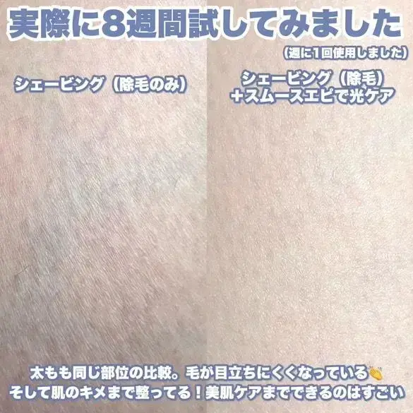 パナソニックの家庭用光美容器にムーブメントの予感!『実際どう?家でムダ毛ケア』の画像