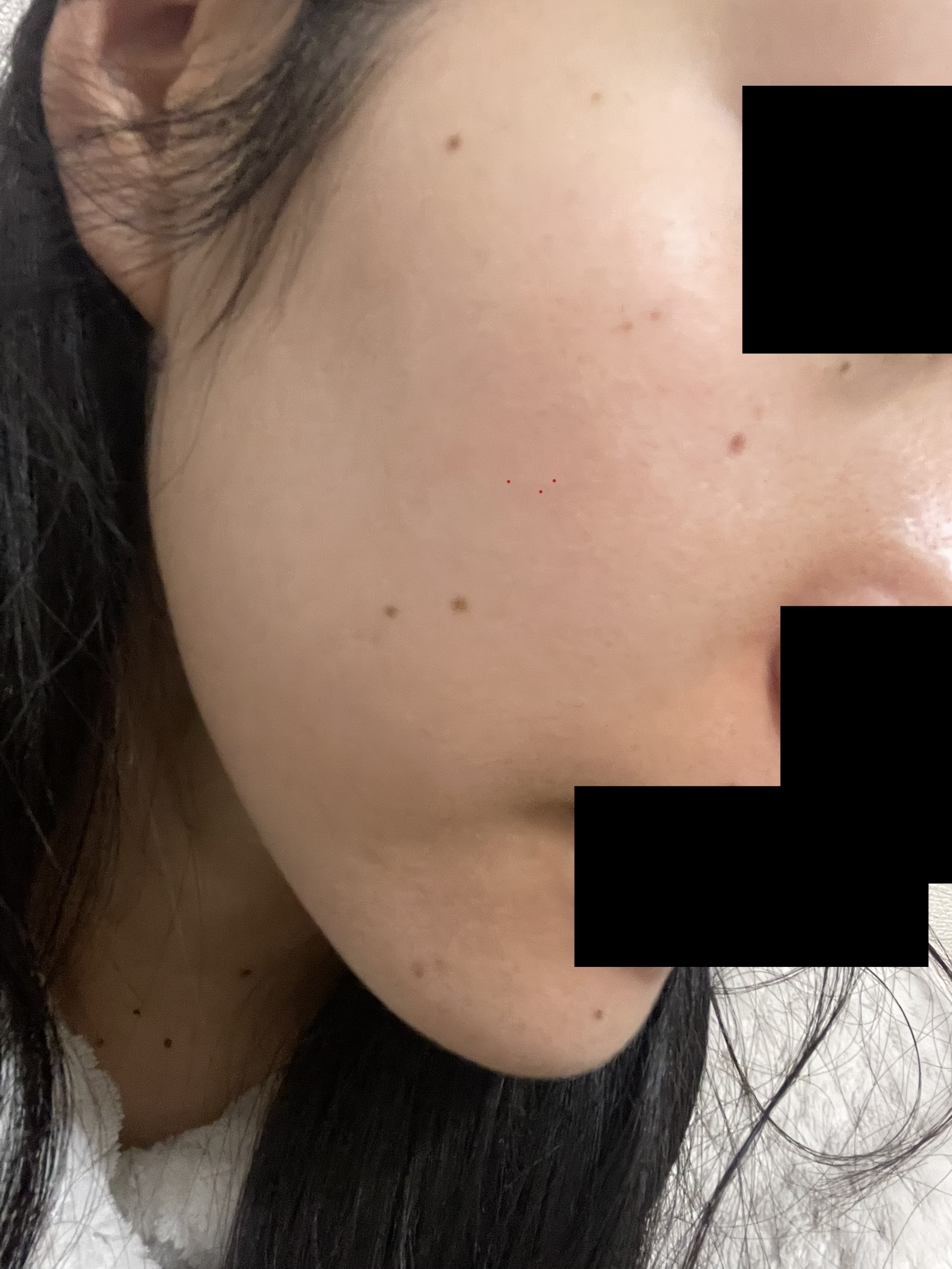 バイオイル/バイオイル/フェイスオイルを使ったクチコミ（2枚目）