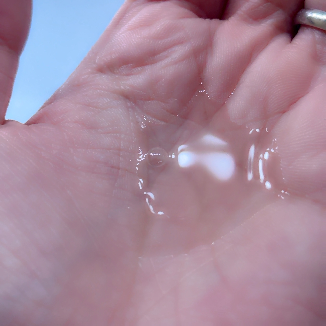 モイストケア ローション MB/d プログラム/化粧水を使ったクチコミ（2枚目）