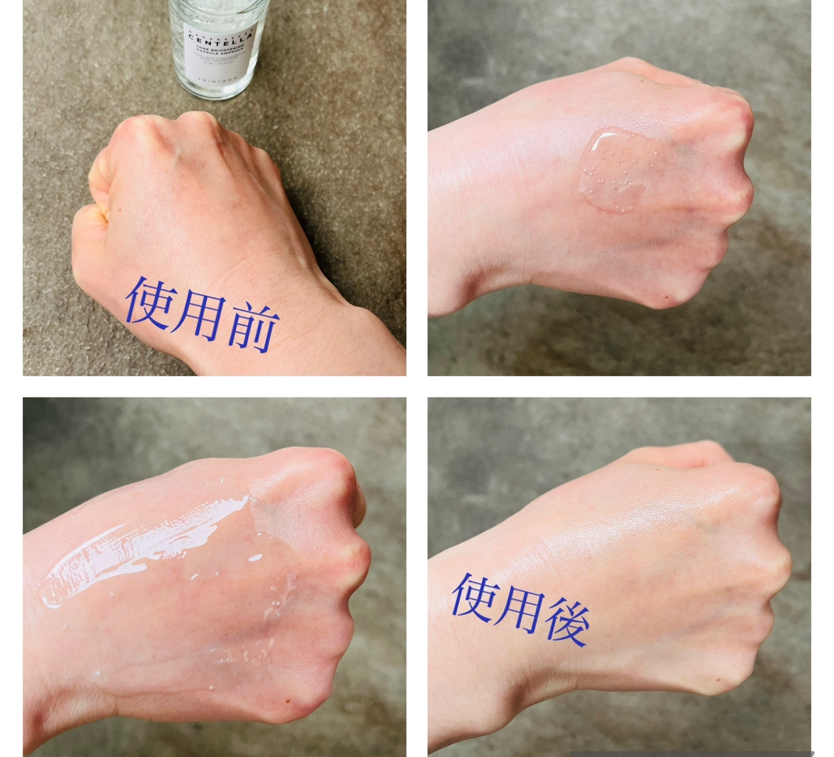 トーンブライトニング カプセルアンプル/SKIN1004/美容液を使ったクチコミ（2枚目）