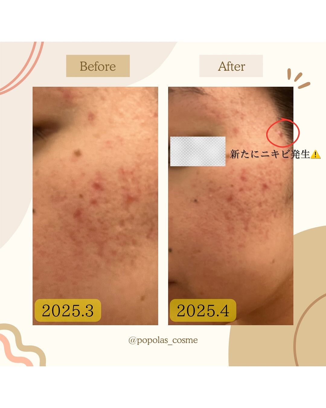 肌をうるおす保湿クリーム/肌をうるおす保湿スキンケア/フェイスクリームを使ったクチコミ(7枚目)