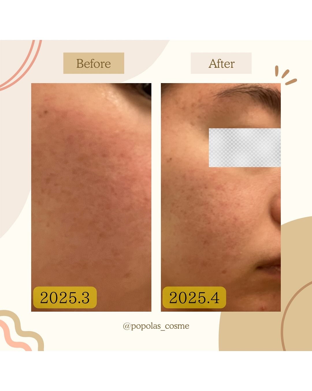 肌をうるおす保湿クリーム/肌をうるおす保湿スキンケア/フェイスクリームを使ったクチコミ(6枚目)