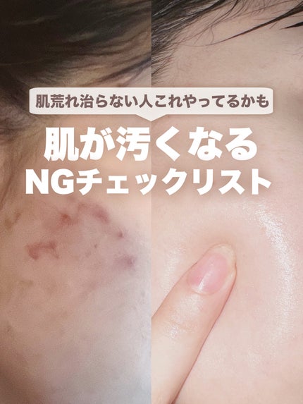 肌美精 CHOIマスク 薬用乾燥肌あれケア/肌美精/シートマスク・パックを使ったクチコミ(1枚目)