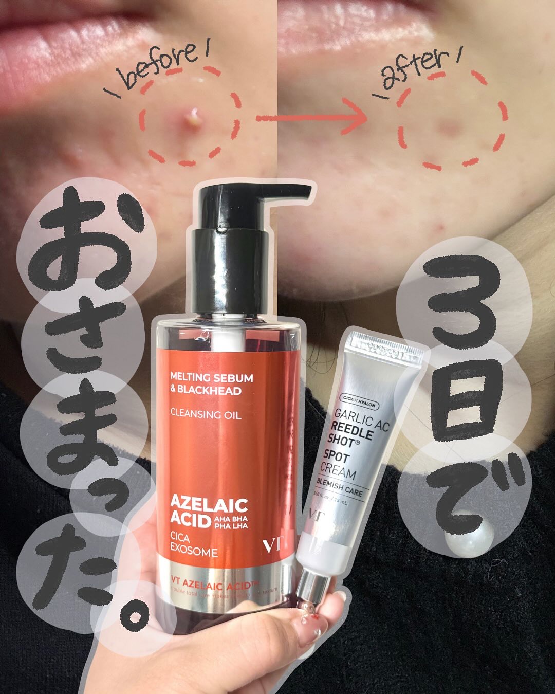 ガーリック リードルショット スポットクリーム/VT/フェイスクリームを使ったクチコミ（1枚目）