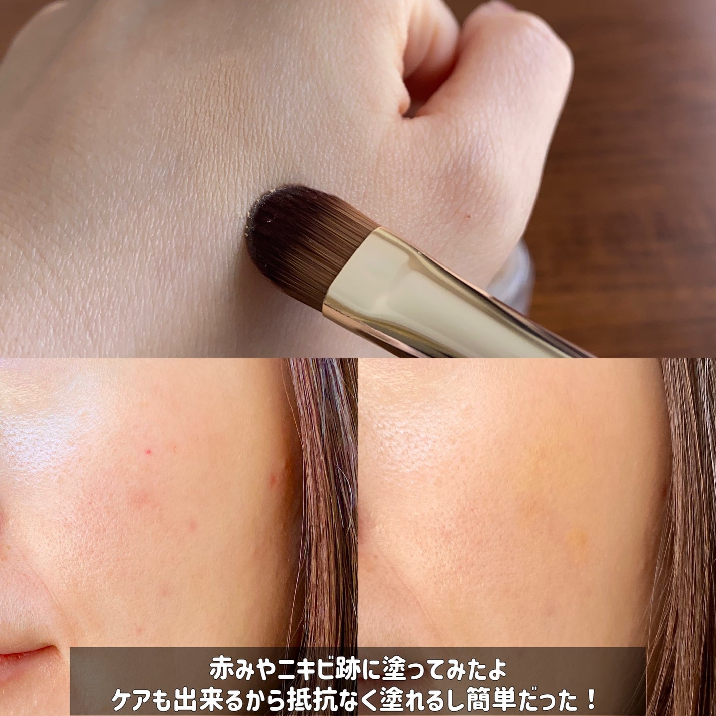 薬用コンシーラー アクネプロテクター/ONLY MINERALS/パウダーコンシーラーを使ったクチコミ(4枚目)