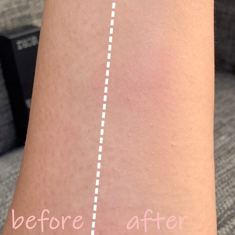 ディオールスキン フォーエヴァー スキン パーフェクト スティック/Dior/その他ファンデーションを使ったクチコミ(4枚目)