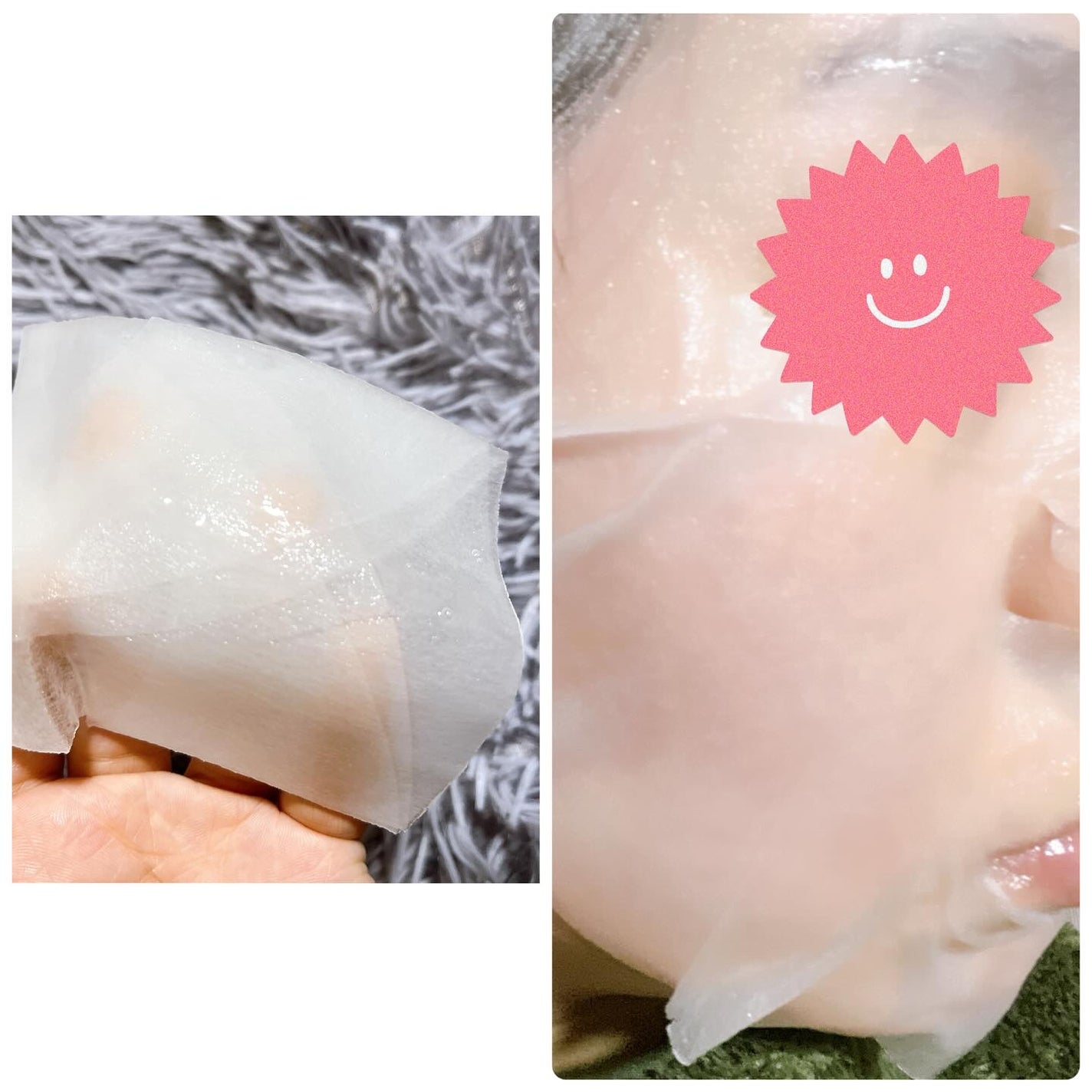 エッセンスマスク/Dermal/シートマスク・パックを使ったクチコミ(3枚目)