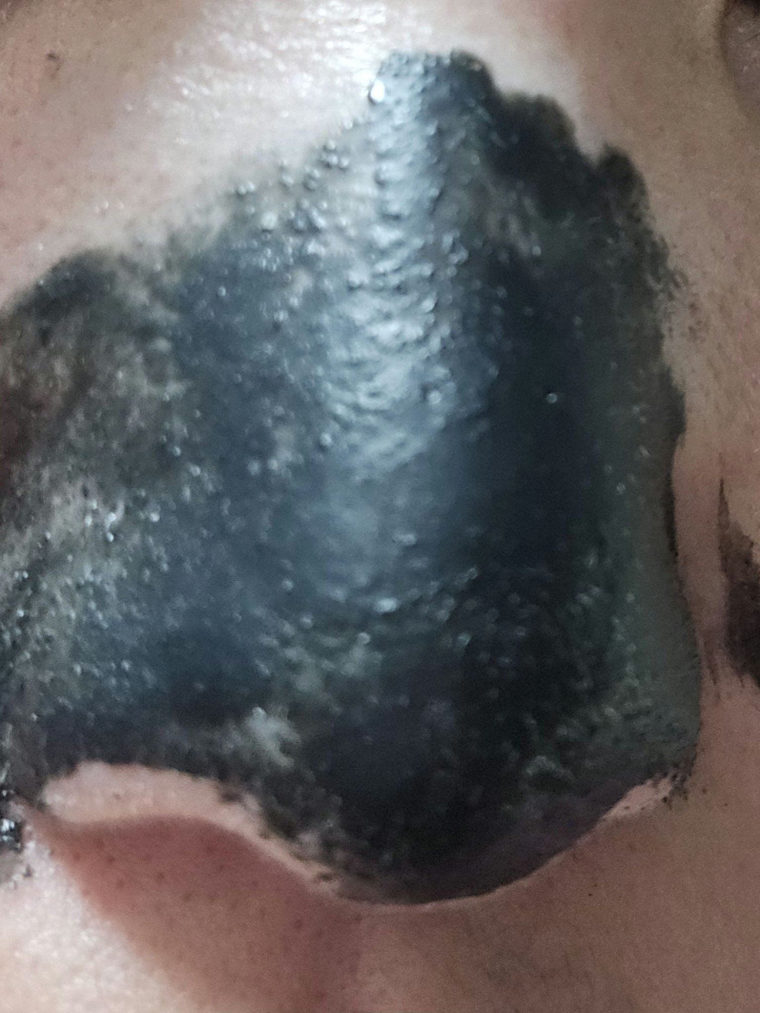 毛穴小町 ブラックピールオフパック/クリアターン/ピーリングを使ったクチコミ（3枚目）