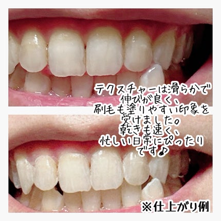 ホワイトクイーン/ハニック・ホワイトラボ/その他オーラルケアを使ったクチコミ(2枚目)