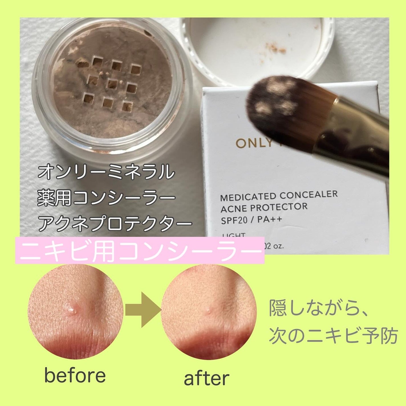 薬用コンシーラー アクネプロテクター/ONLY MINERALS/パウダーコンシーラーを使ったクチコミ(2枚目)