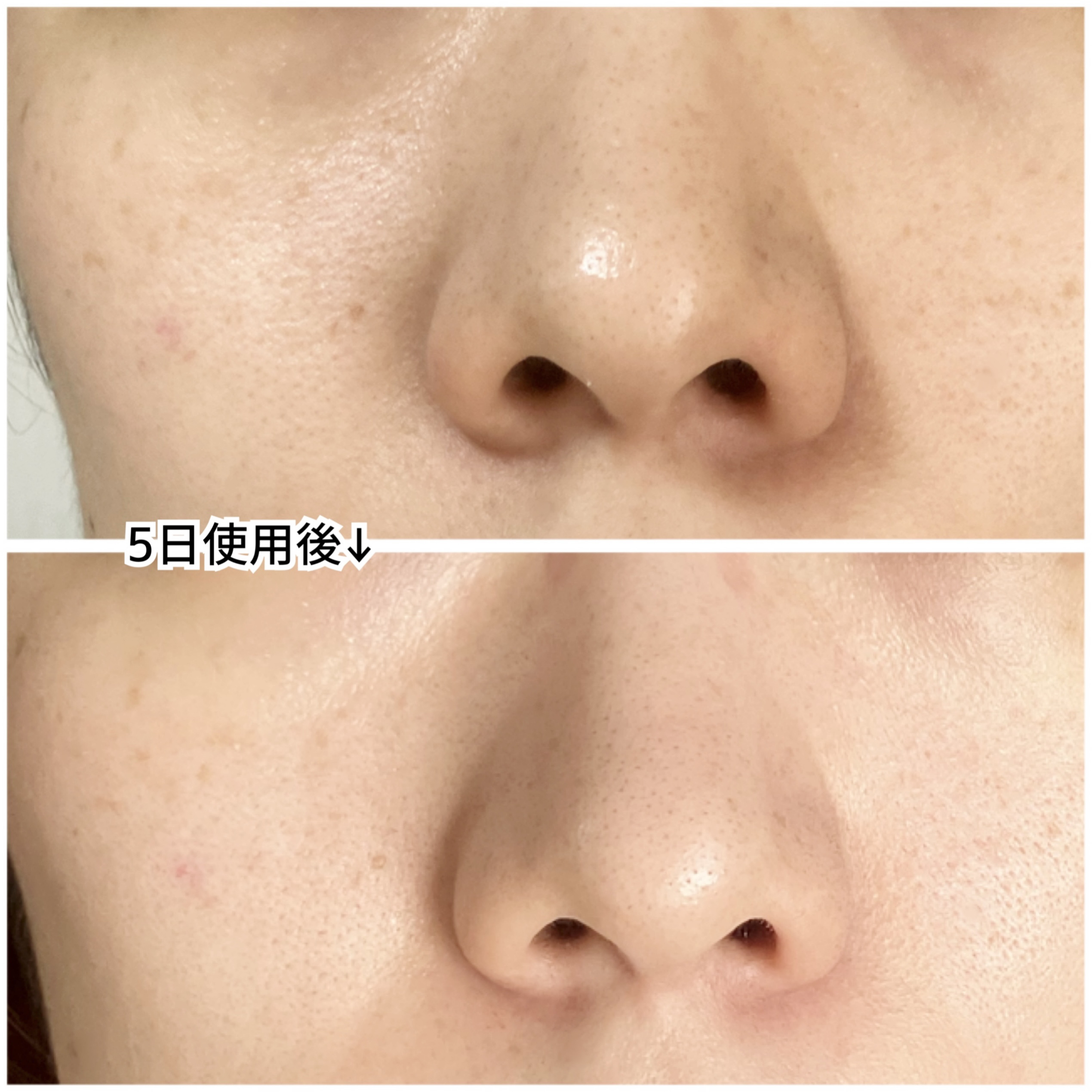 ブラックチェリー 毛穴引き締めクリーム ロフディ/ODELOI/フェイスクリームを使ったクチコミ（3枚目）