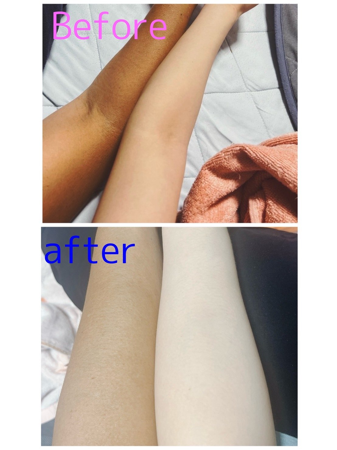 スノーセル/メディタミン/美容サプリメントを使ったクチコミ（2枚目）