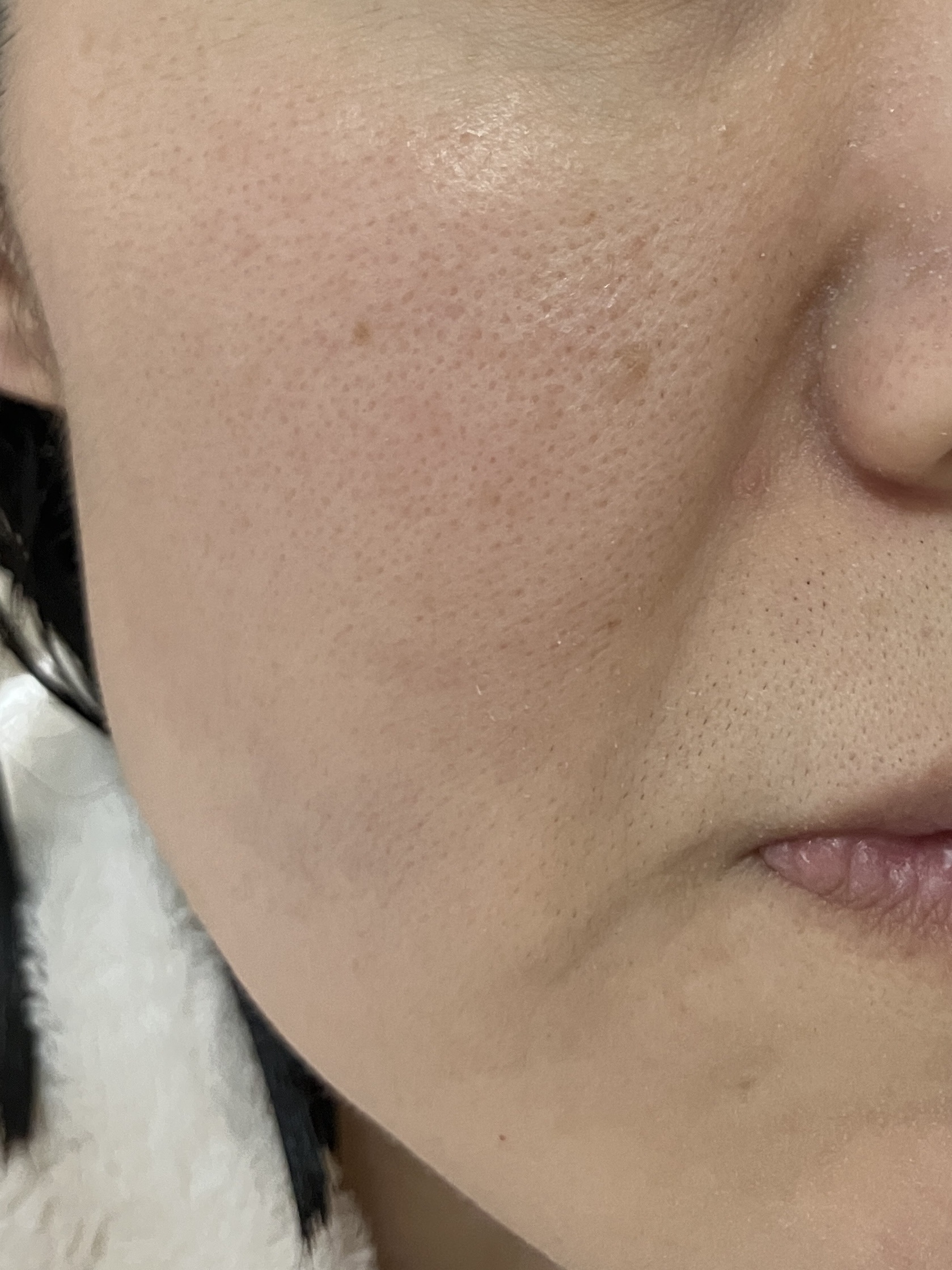 ロゼット洗顔パスタ アクネクリア/ロゼット/洗顔フォームを使ったクチコミ（3枚目）