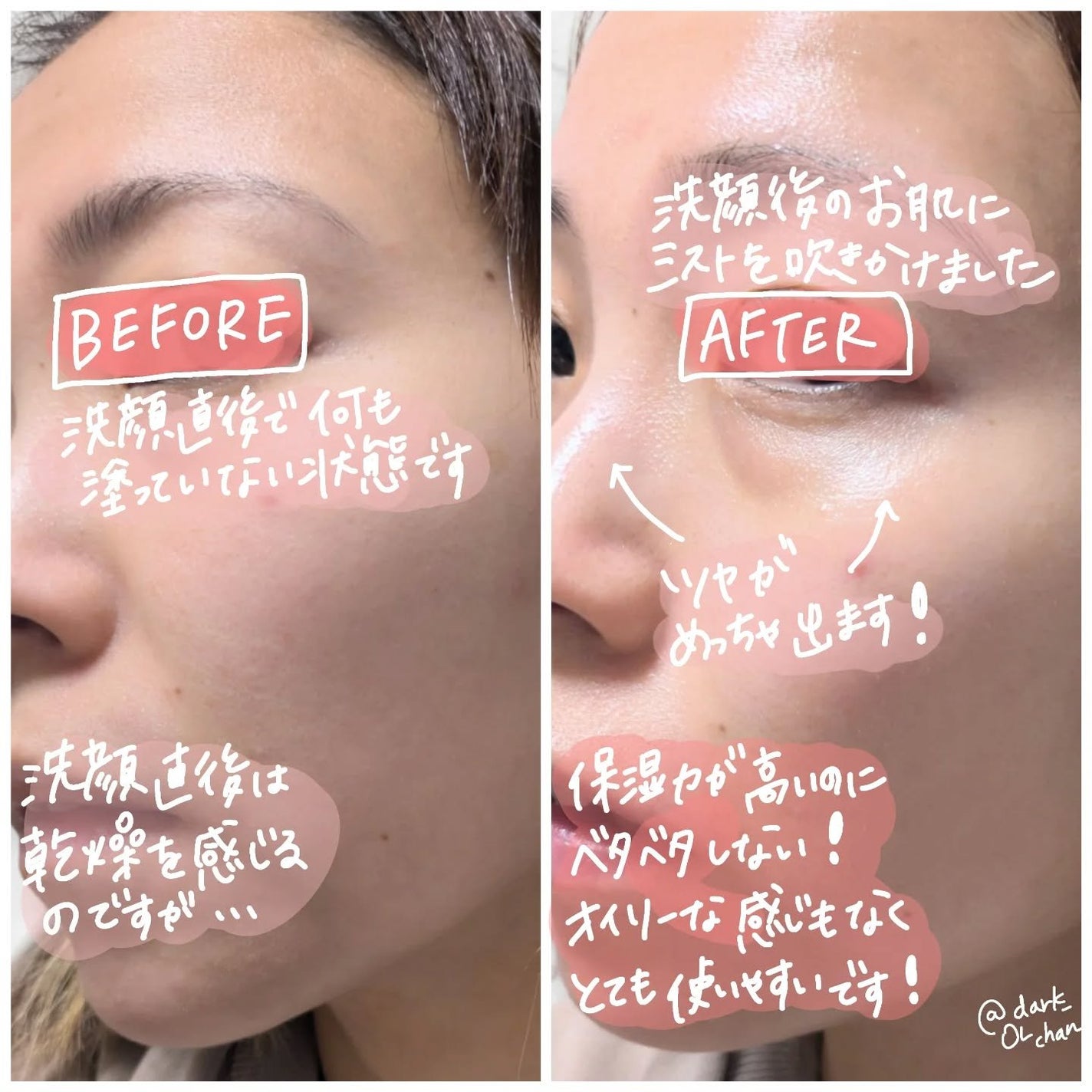 PDRNピンクセラムミスト/MEDICUBE/美容液を使ったクチコミ(3枚目)