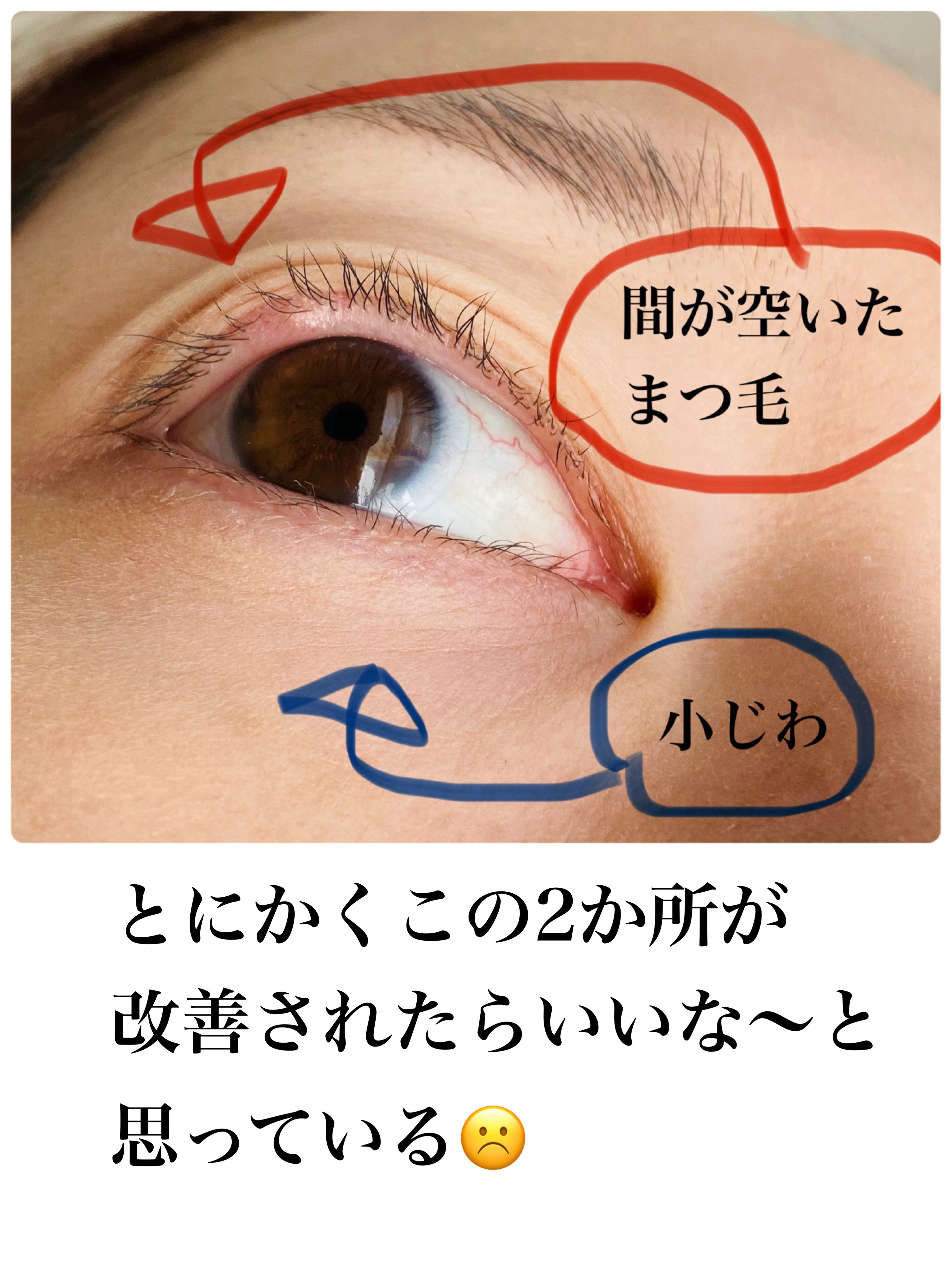 リンクルアイクリーム N/なめらか本舗/アイケア・アイクリームを使ったクチコミ（3枚目）