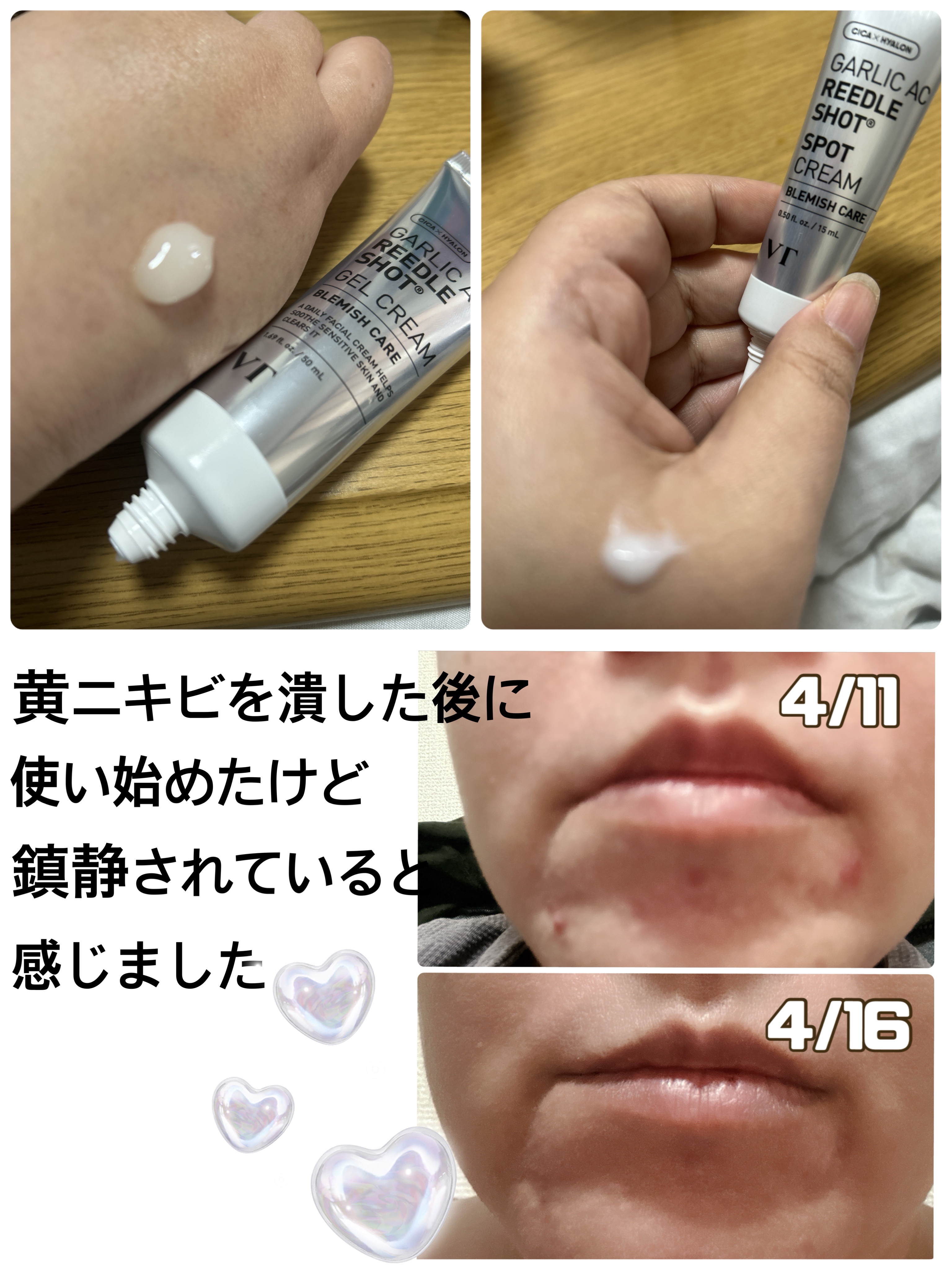 ガーリックリードルショット ジェルクリーム/VT/フェイスクリームを使ったクチコミ（2枚目）