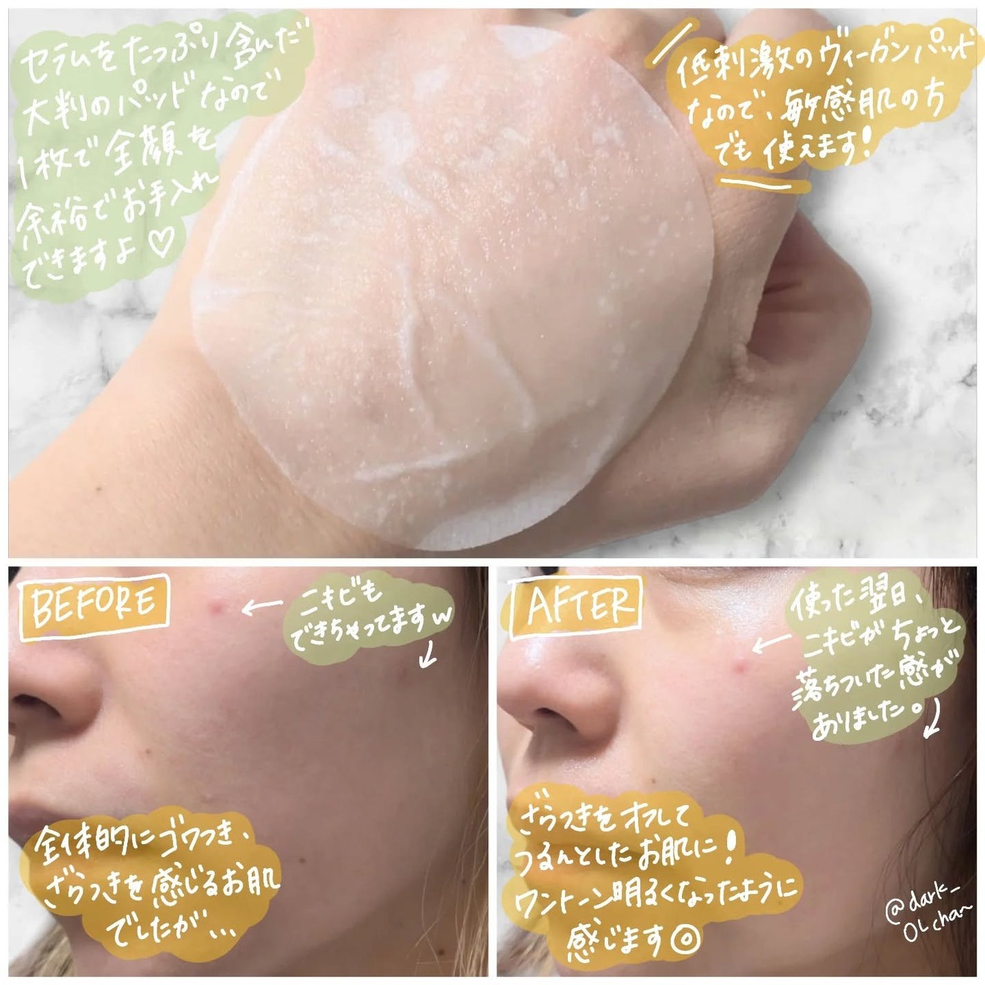 カロテンIPMP(TM) ブレミッシュカーミングセラムパッド/APRILSKIN/トナーパッドを使ったクチコミ(2枚目)