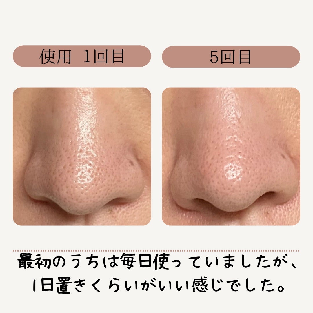 AQ 毛穴美容液オイル/DECORTÉ/フェイスオイルを使ったクチコミ(2枚目)