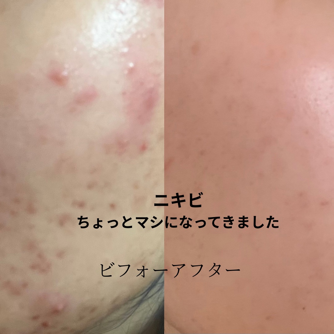 クリアフル ディープクレンジングリキッド/オルビス/クレンジングウォーターを使ったクチコミ（1枚目）