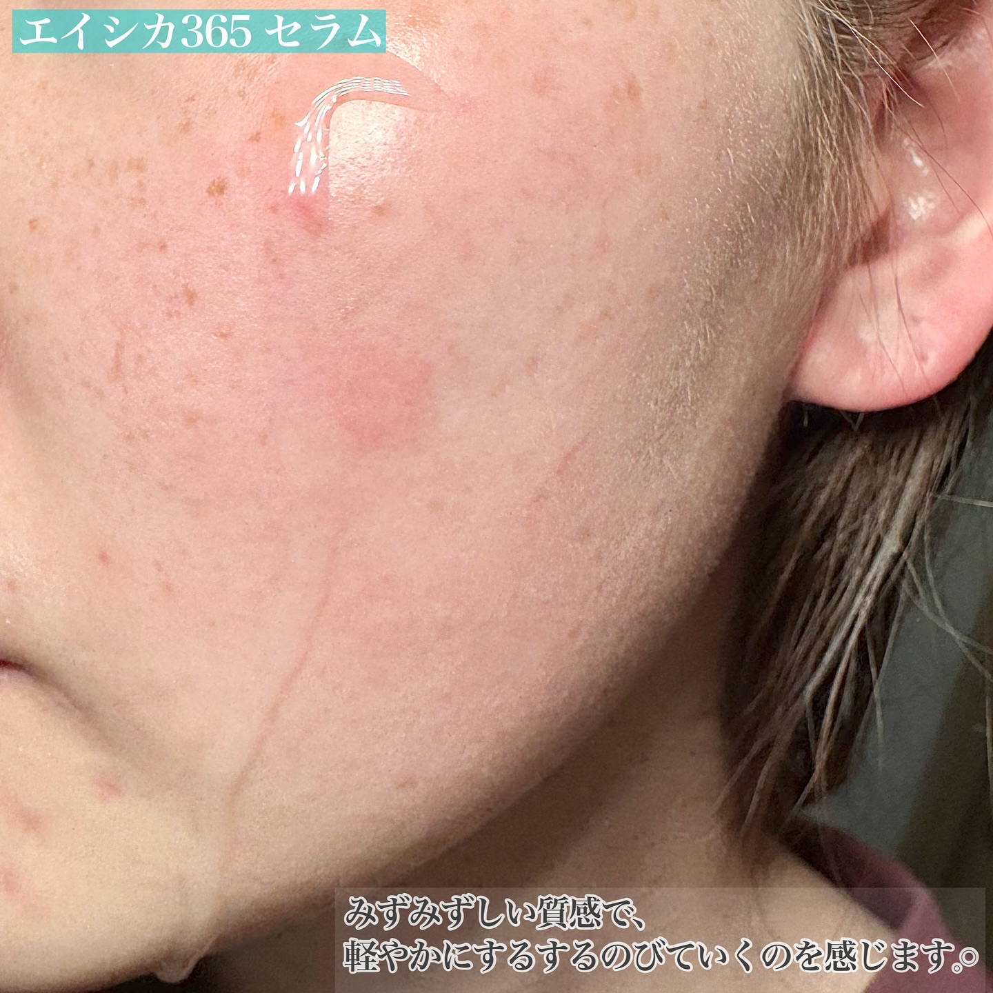 エイシカ365クイックマスクパッド/AESTURA/トナーパッドを使ったクチコミ（3枚目）