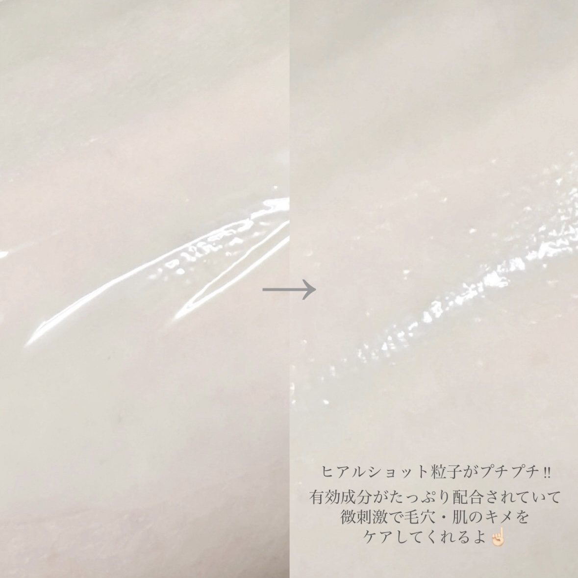 氷河水 ヒアルロン酸セラム/mixsoon/美容液を使ったクチコミ（3枚目）
