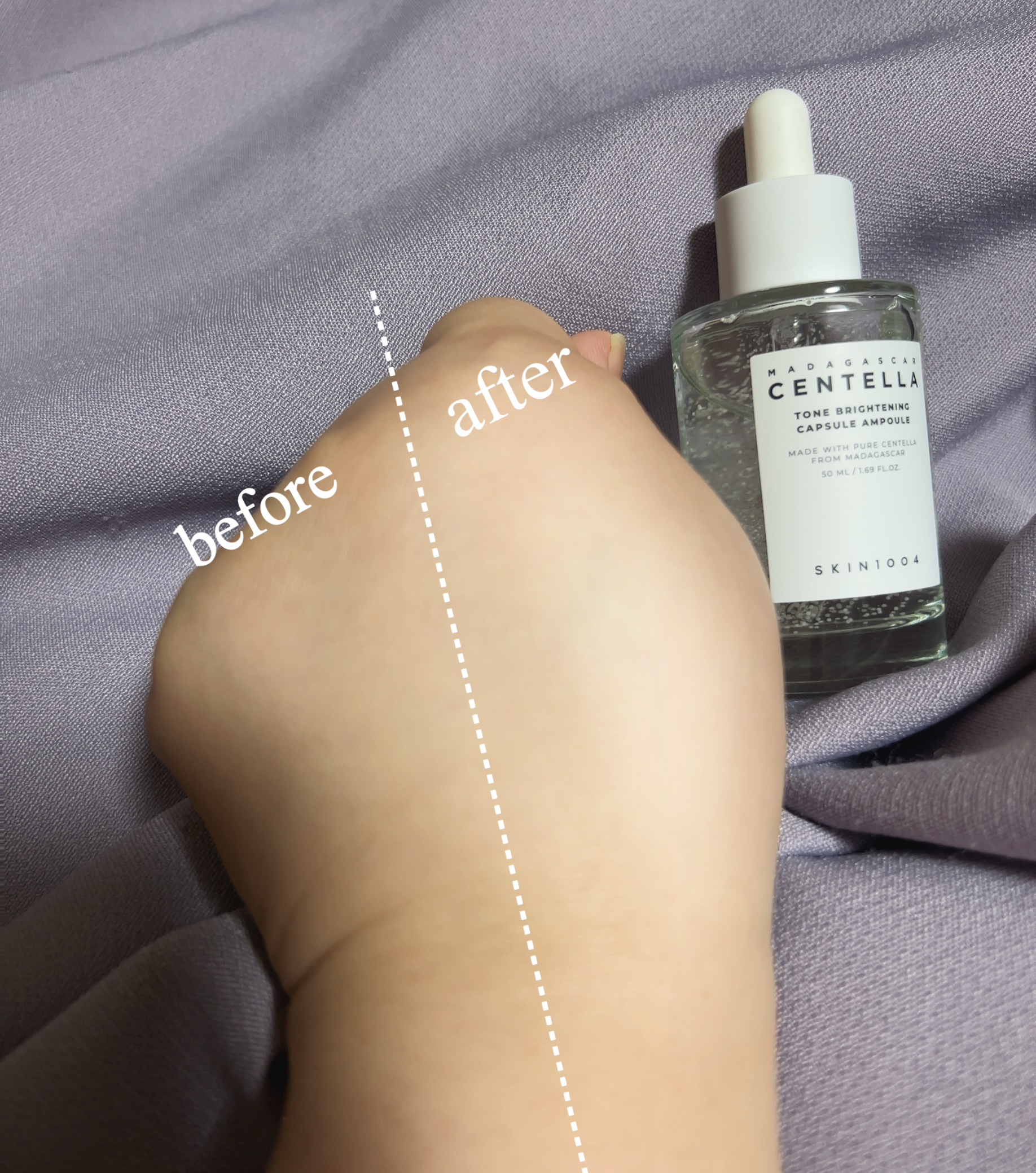 トーンブライトニング カプセルアンプル/SKIN1004/美容液を使ったクチコミ（2枚目）