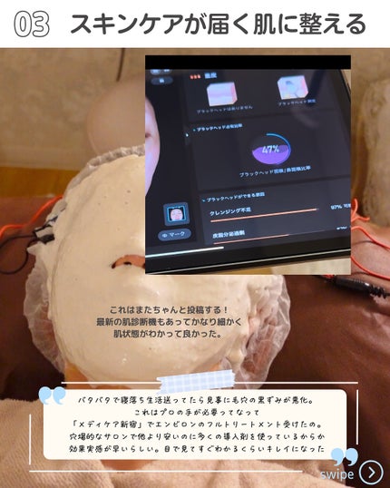 モルバニーHLCGクレンザー/molvany/クレンジングジェルを使ったクチコミ(4枚目)