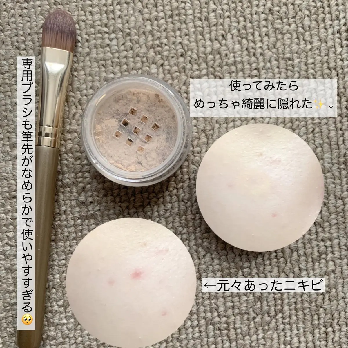 薬用コンシーラー アクネプロテクター ライト(旧名：ベージュ)/ONLY MINERALS/パウダーコンシーラーを使ったクチコミ（2枚目）