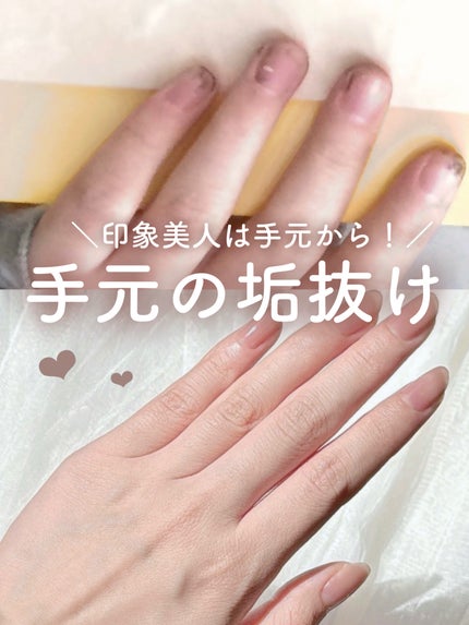 デイケアオイル/Dr.Nail/ネイルオイル・トリートメントを使ったクチコミ(1枚目)