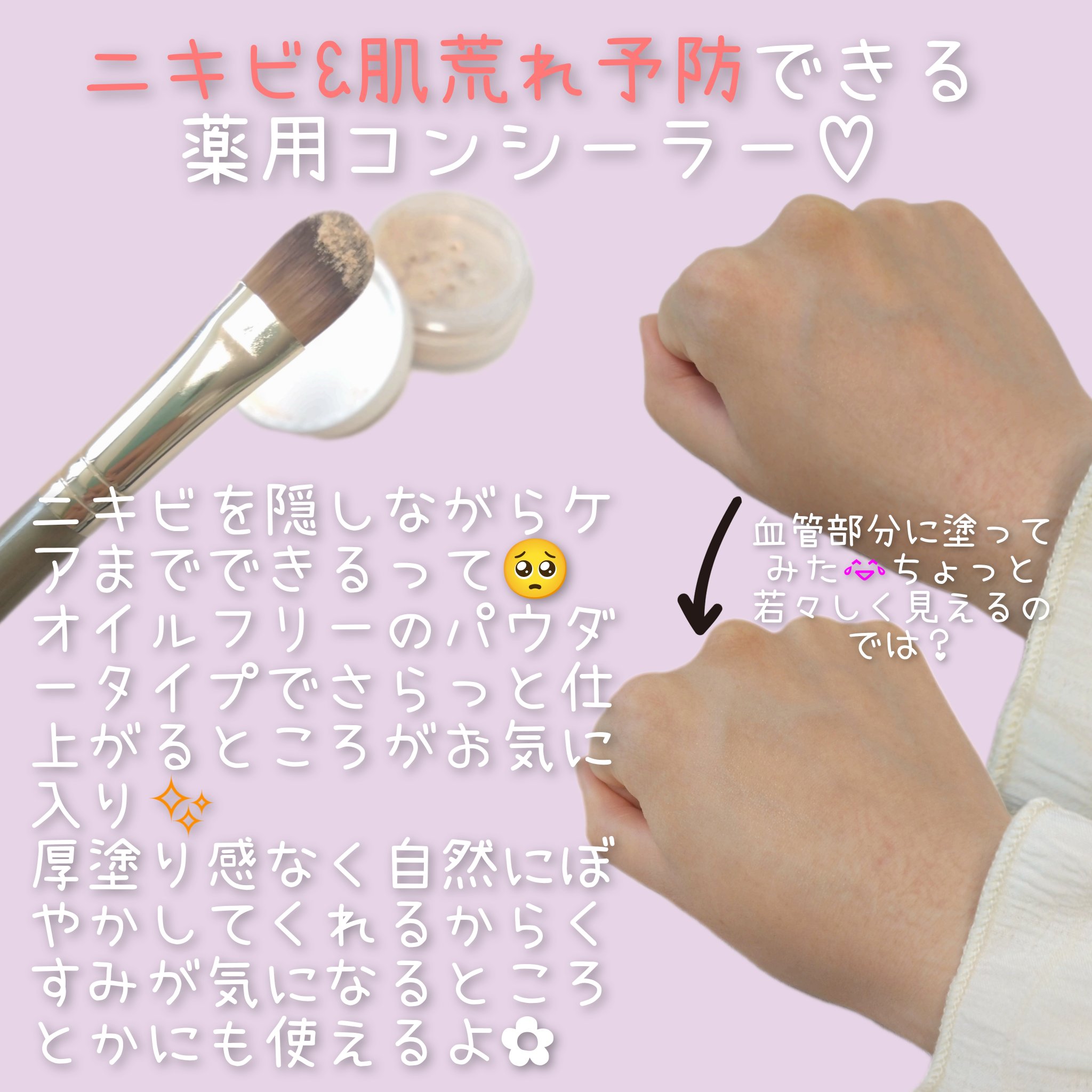 薬用コンシーラー アクネプロテクター ライト(旧名：ベージュ)/ONLY MINERALS/パウダーコンシーラーを使ったクチコミ（2枚目）