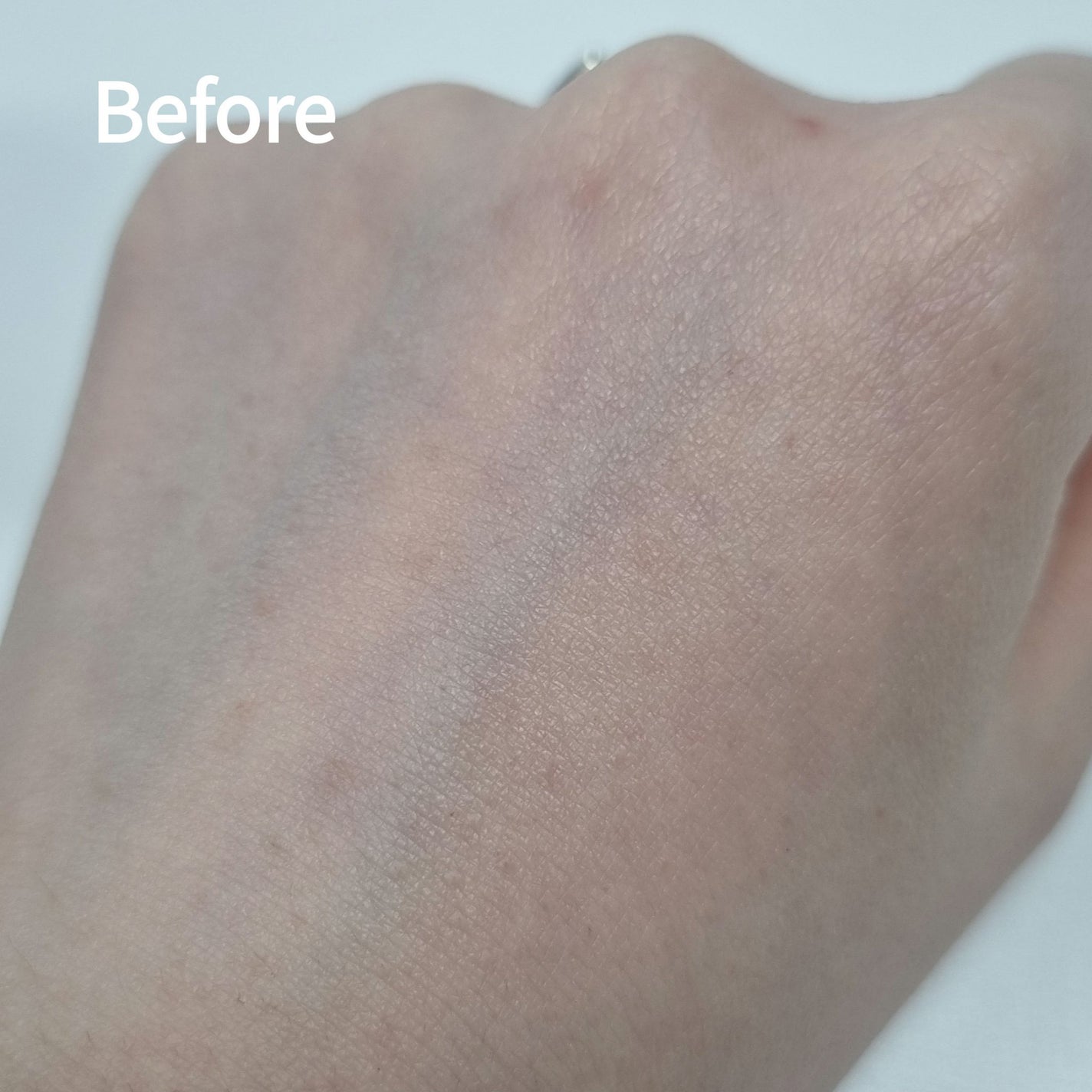 RXザ・アルファアルブチン2 ニキビ跡ケアセラム/COSRX/美容液を使ったクチコミ(4枚目)