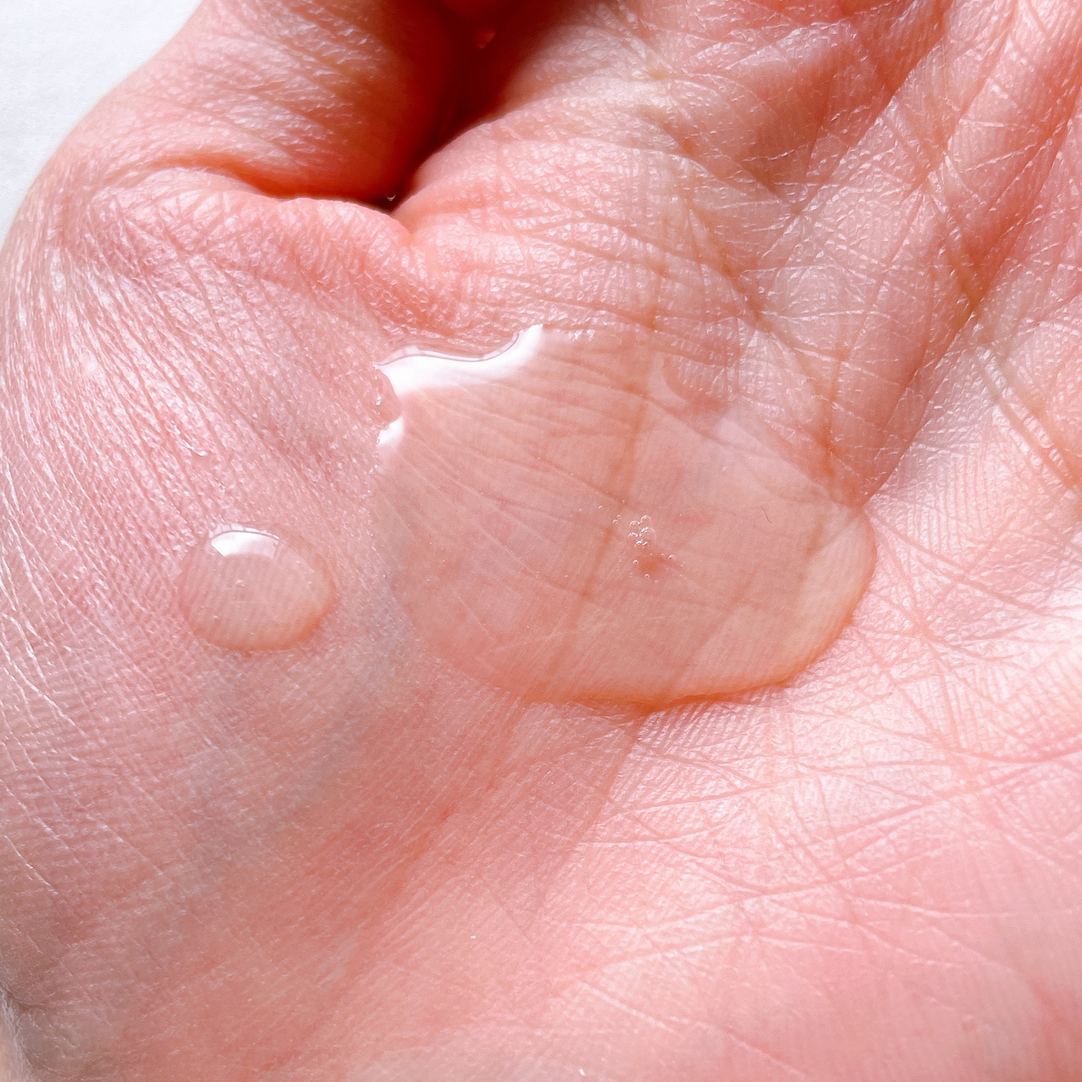 薬用ローション センシティブEX/ドクターシーラボⓇ/化粧水を使ったクチコミ（2枚目）