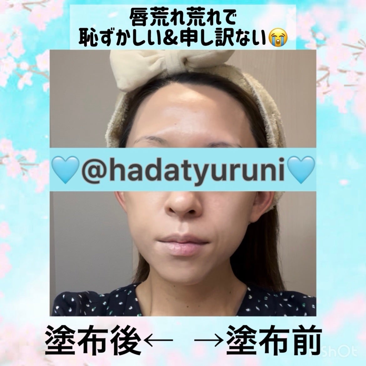 ヒーロークッション+レフィルセット/APRILSKIN/クッションファンデーションを使ったクチコミ(5枚目)