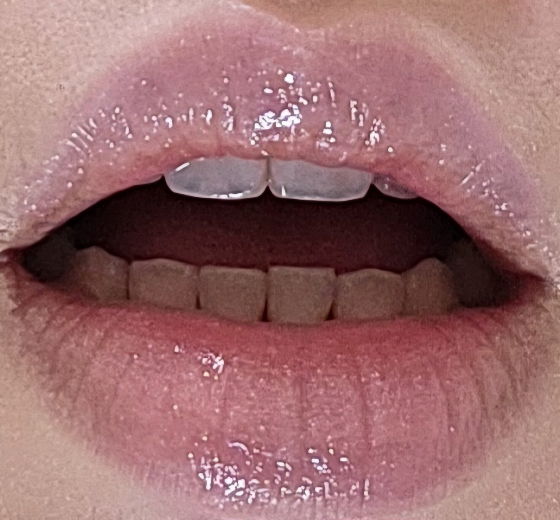 shining lip plumper /mirrorside/リッププランパーを使ったクチコミ（1枚目）