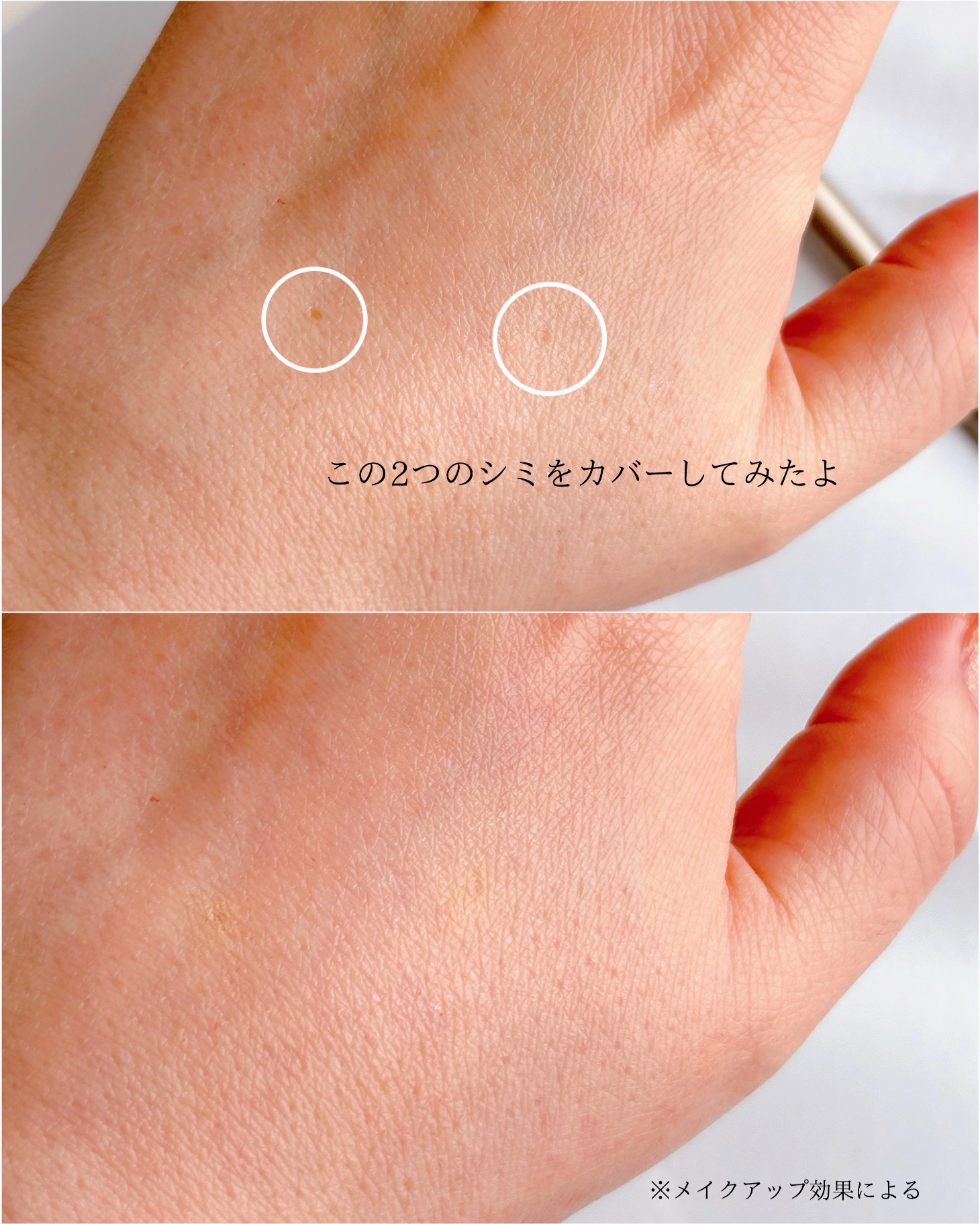 薬用コンシーラー アクネプロテクター/ONLY MINERALS/パウダーコンシーラーを使ったクチコミ（3枚目）