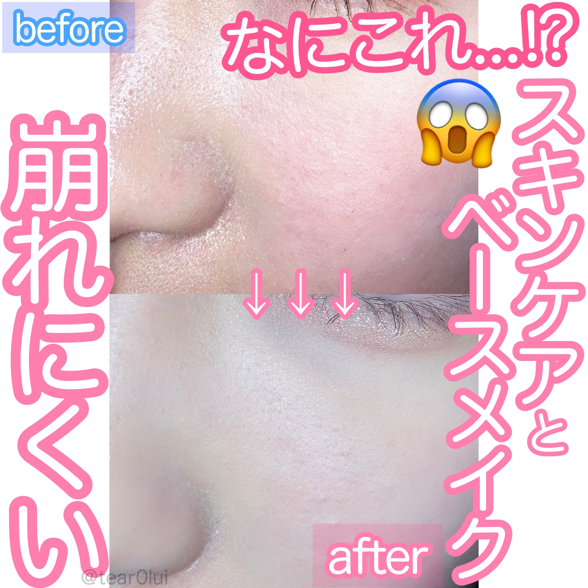 DETクリア ブライト＆ピール ピーリングジェリー＜無香料タイプ＞/Detclear/ピーリングを使ったクチコミ（1枚目）